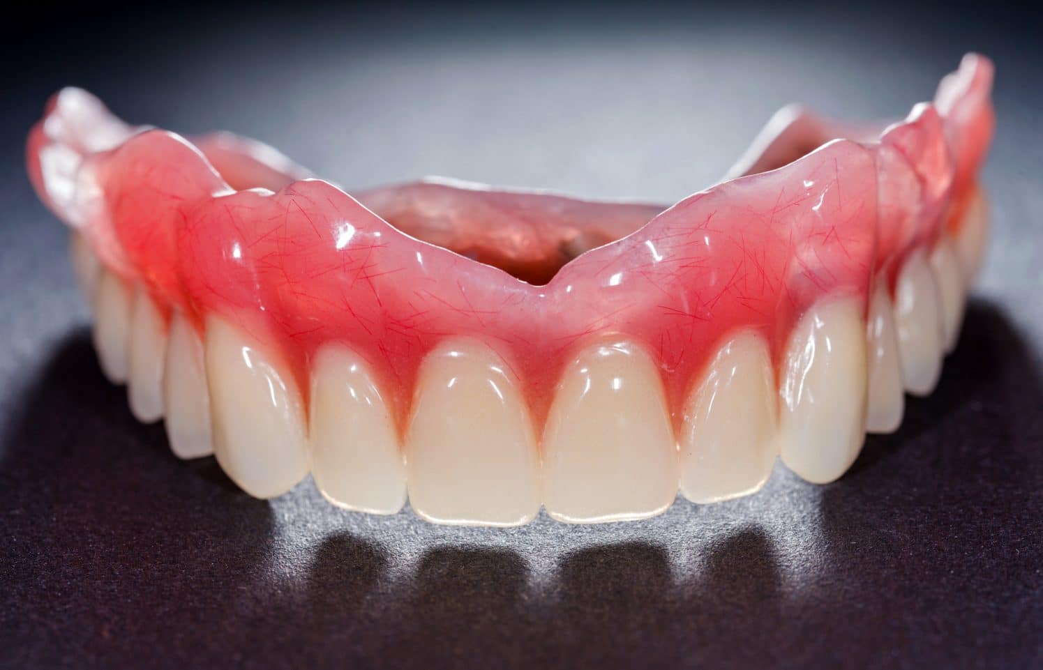 پروتزهای دندانی متحرک