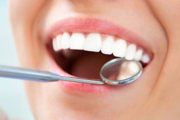 مراحل عصب کشی و پرکردن دندان 