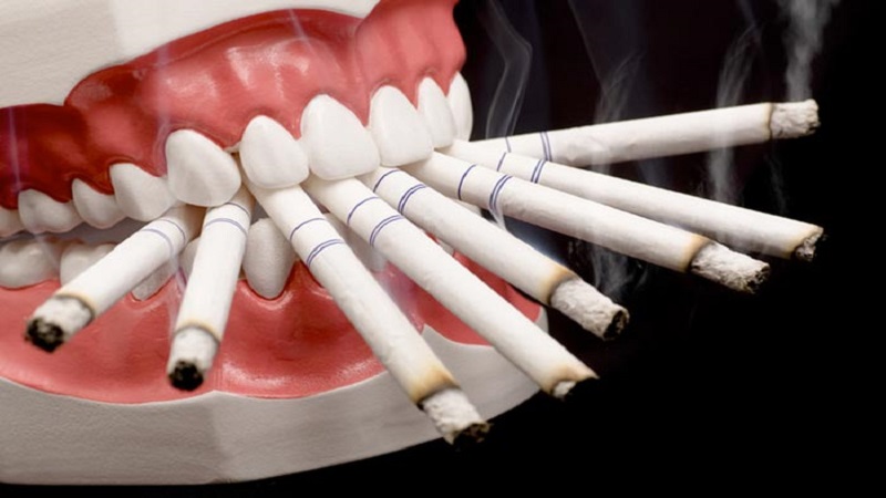 افراد سیگاری و دندان