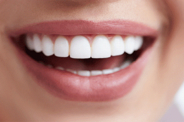 دندانپزشک زیبایی خوب