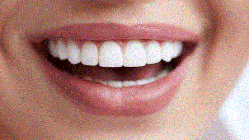 دندانپزشک زیبایی خوب
