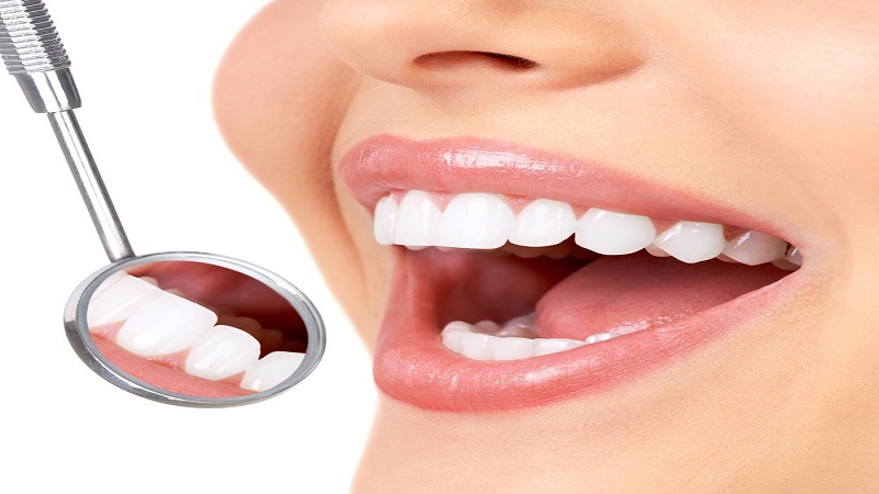 درمان های دندانپزشکی زیبایی
