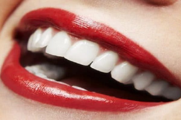 دندانپزشکی زیبایی اصفهان