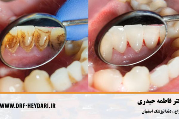 بهترین دندانپزشک اصفهان