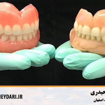 پروتزهای دندانی اصفهان