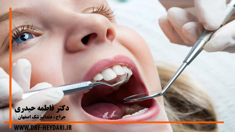 درمان حفره های دندان