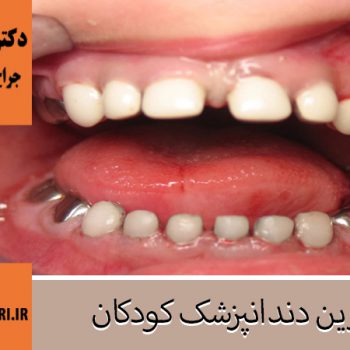 دکتر فاطمه حیدری | جراح دندانپزشک اصفهان | بهترین دندانپزشک اصفهان