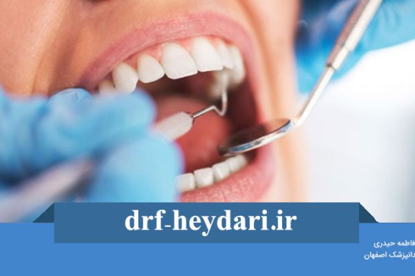 فواصل بین دندان‌های کودکان و تاثیر آن بر سلامت دهان