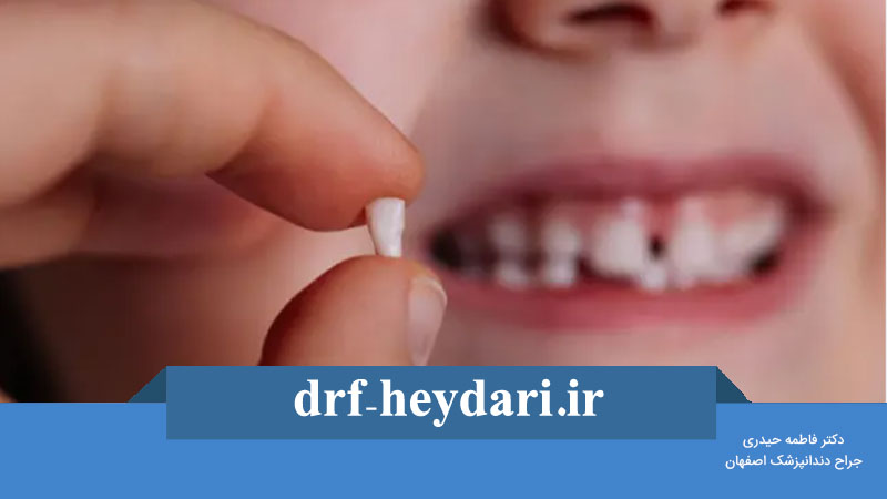 مضرات کشیدن دندان شیری زودتر از موعد
