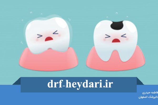 درمان کرم خوردگی دندان کودکان