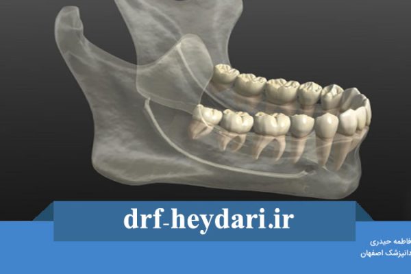 پیوند استخوان فک پایین