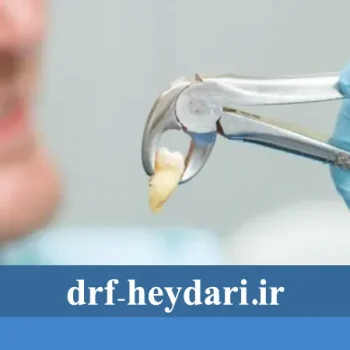 مراقبت‌های بعد از کشیدن دندان چیست؟