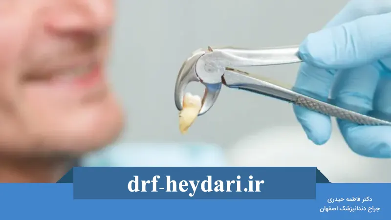 مراقبت‌های بعد از کشیدن دندان چیست؟
