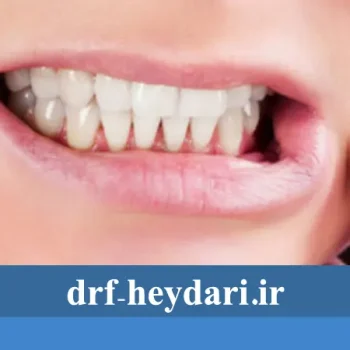 چگونه حساسیت دندان را کاهش دهیم؟
