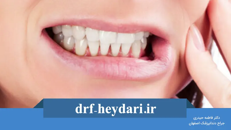 چگونه حساسیت دندان را کاهش دهیم؟