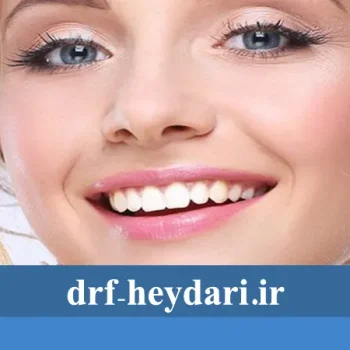 چگونه لبخندی زیبا داشته باشیم؟