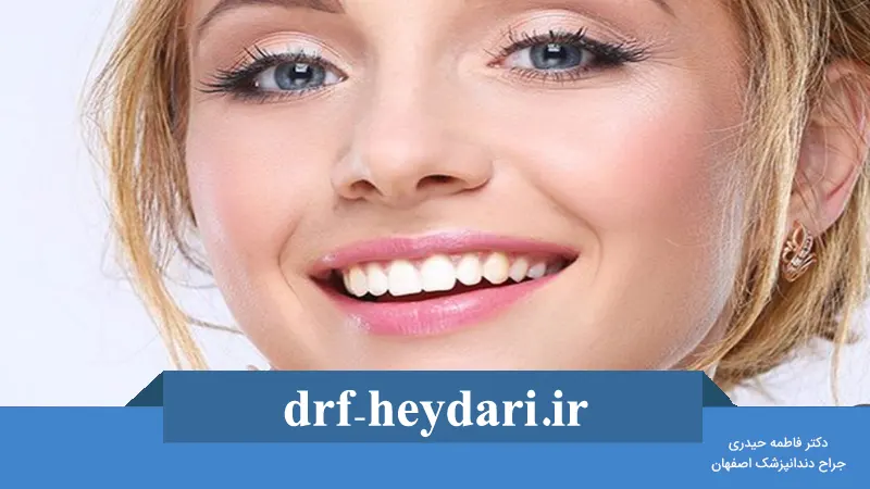 چگونه لبخندی زیبا داشته باشیم؟