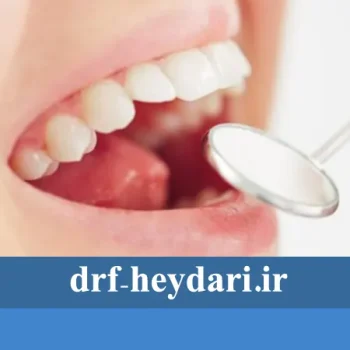 چه زمانی نیاز به کشیدن دندان داریم؟