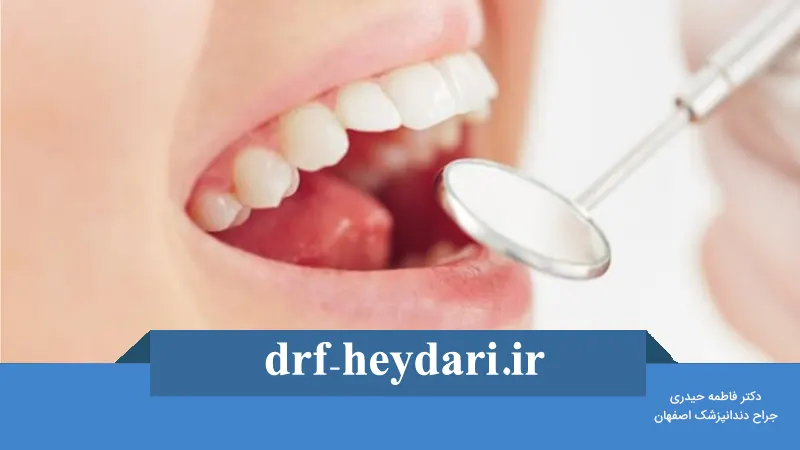 چه زمانی نیاز به کشیدن دندان داریم؟