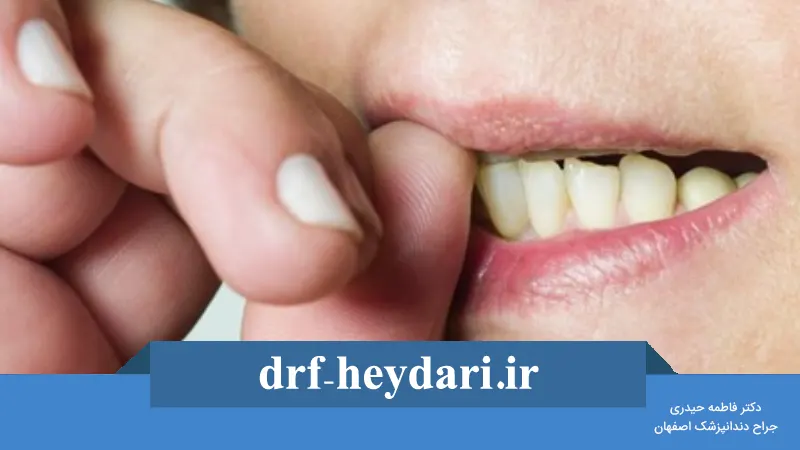 تأثیر استرس بر سلامت دهان