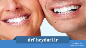 دندانهای سفید
