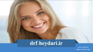 اصلاح طرح لبخند
