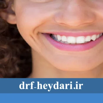 اصلاح طرح لبخند
