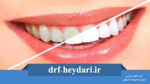 نقش بهداشت دهان