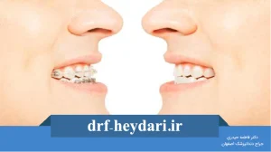 نقش ارتودنسی در اصلاح مشکلات فک